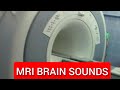 MRI Sounds Inside Scan Room Brain MRI Noise Sound Effects MRI