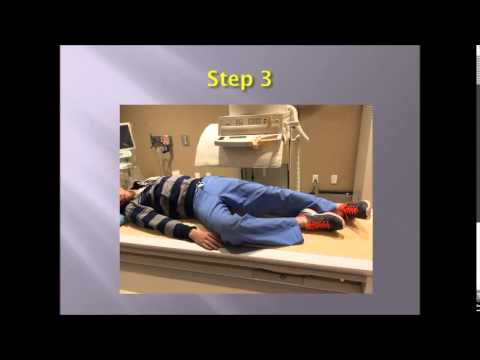 Retrograde Urethrogram