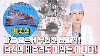코를 다친 기억이 없는데 비중격 골절!? 이미 당신의 코는  부러져 있습니다 ㅣ 와이영성형외과