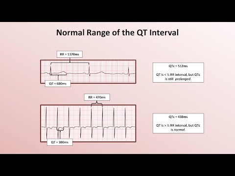 Advanced EKGs - The QT Interval and Long QT Syndrome