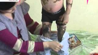 Мальчик с чешуёй вместо кожи - Видео онлайн
