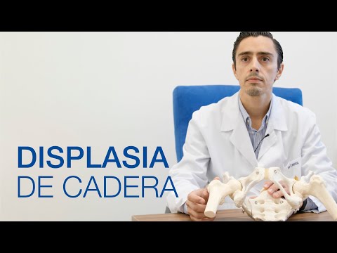 , title : 'Displasia de Cadera: causas y tratamiento'