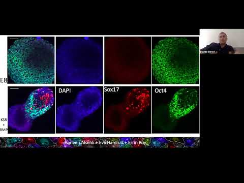 YouTube video