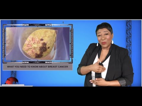 What you need to know about breast cancer (ASL - 10.6.19)