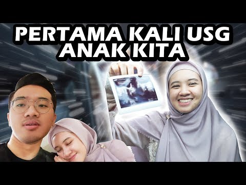 PERTAMA KALI USG ANAK KITA :')