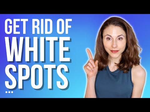 HOW TO GET RID OF WHITE SPOTS ON SKIN | DERMATOLOGIST @DrDrayzday
