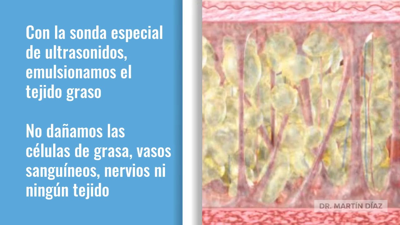 Marcos Martín Díaz-12