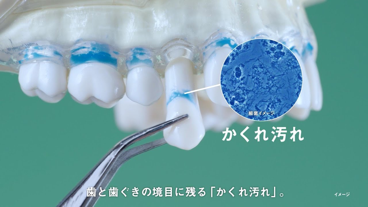 ドルツ水流洗浄器ジェットウォッシャーかくれ汚れ落とし実証動画【パナソニック公式】