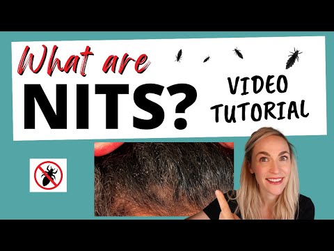 What are Nits? Video!