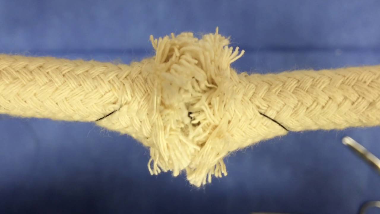 Extensor Tendon Repair