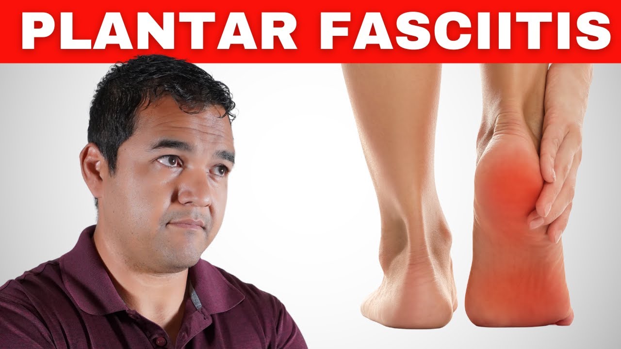 Top 6 Exercises for Healing the Root Problem of Plantar Fasciitis