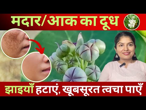 Remove Melasma with Aak (Madar) Milk and get spotless glowing skin | Aak ka doodh #drvandanaayulab