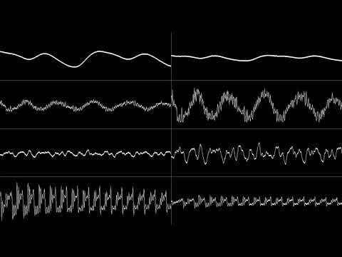 Captain/Image - Space Debris (Oscilloscope View)