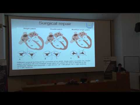 Surgery of atrioventricular canal defects (AVSD) - Shunji Sano