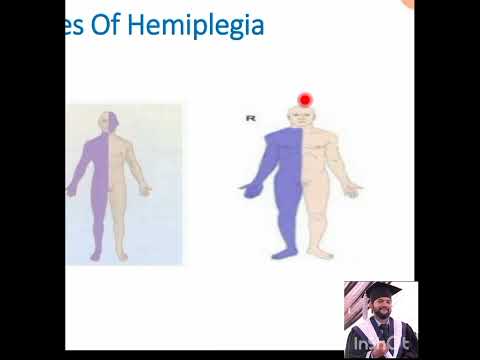 #Localization of Neurological Lesion/weakness#Lecture 3 by Dr Bilal kz (Neurologist-Author-Tutor)