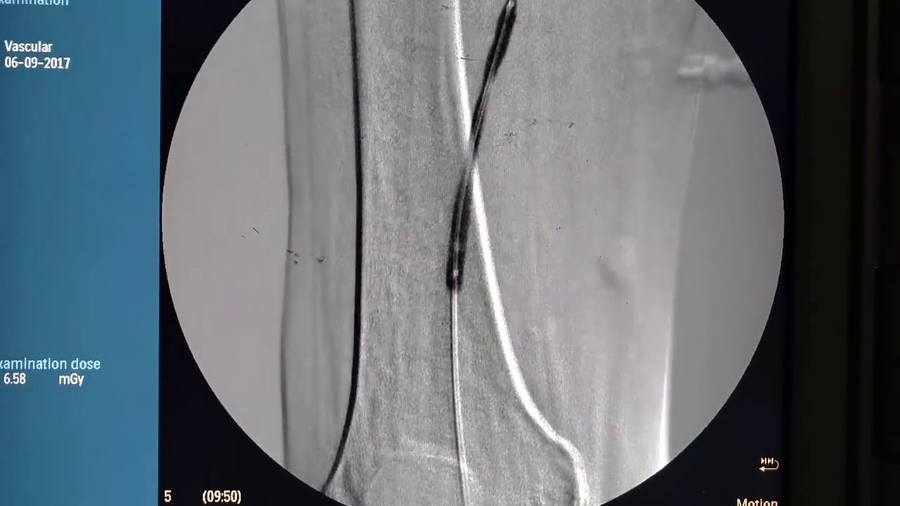 Jesus Alejandro Armendáriz López-11