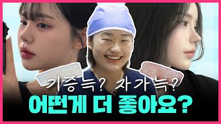 코 성형 늑연골 뭐 쓸지 모르겠는 사람 손? 전문의가 다 알려드림!