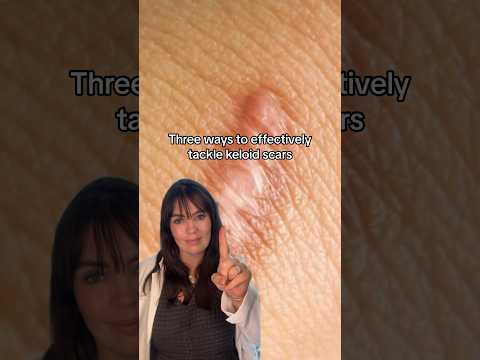 How to get rid of keloid scars non-surgically👆🏽 #keloid #keloidtreatment #scarremoval #scarring