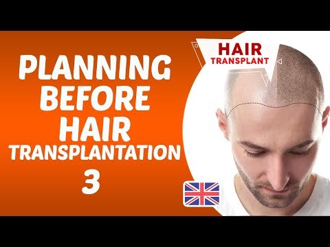 Planning Before Hair Transplantation3 - Dr Hamid AYDIN