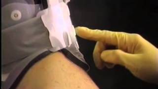 Product video: Aspen CTO Brace (Cervical Thoracic Orthosis)