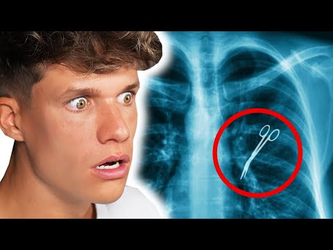 DIESE Dinge wurden im MENSCHLICHEN Körper gefunden 😱