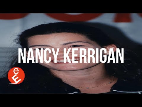 🔴 NANCY KERRIGAN - Explained EASY in 5 minutes