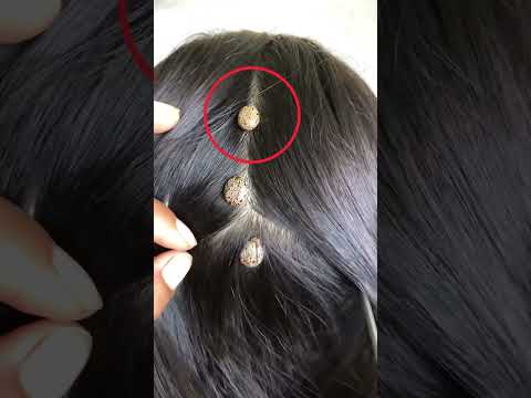 Нещо излезе от косата ми 😨⚠️