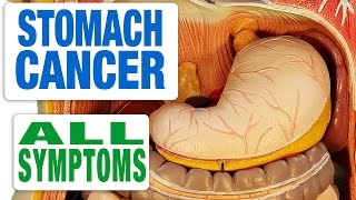 Stomach Cancer - All Symptoms