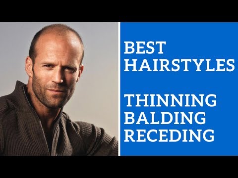download lagu mp3 mp4 Haircuts For Men With Balding Hair, download lagu Haircuts For Men With Balding Hair gratis, unduh video klip Haircuts For Men With Balding Hair