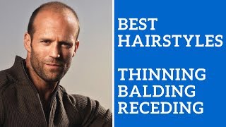 Best Men's Hairstyles for Thinning Hair, Balding Hair, or Receding Hair Line