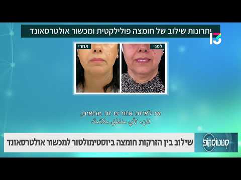 שילוב בין חומצה ביוסטימולטור למכשור אולטרסאונד