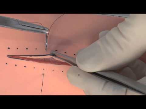 SIM SUTURE - 6. The Vertical Mattress Suture