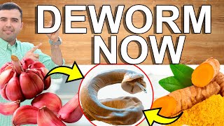 DEWORM NOW! - How to Parasite Cleanse at Home - Home Remedies That Cleanse And Detoxify Your Colon