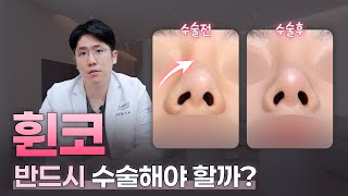 휜 코의 원인이 얼굴 때문이라고요? 교정 안 된다고요? 들어와 보세요!