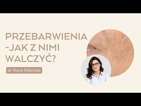Przebarwienia Skórne? Jak Z Nimi Walczyć? Radzi Dermatolog!