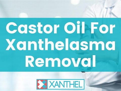 Castor Oil For Xanthelasma Removal
