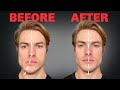 How to Fix Asymmetrical Jaw & Face (FOREVER)