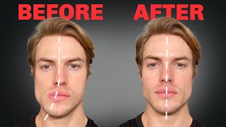 How to Fix Asymmetrical Jaw &amp; Face (FOREVER)