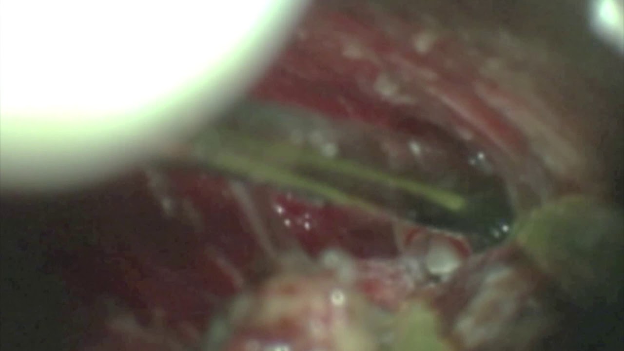 Jean G. De Oliveira-21