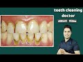 Teeth Cleaning Doctor
