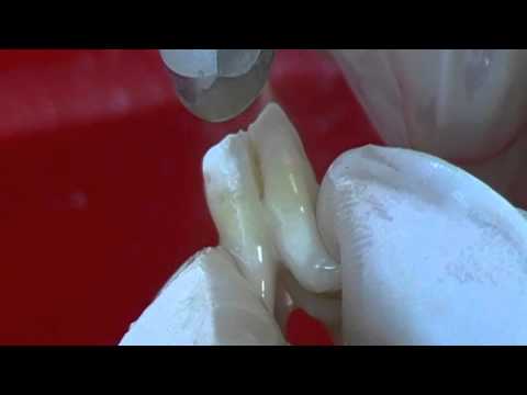 Doctor Smile Pluser Erbium YAG 10W