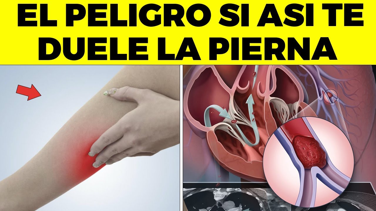 ALERTA! Por Esta Peligrosa Razón TE DUELE LA PIERNA Y Nadie Te Lo Dice