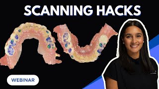 Scanning Hacks Every Dental Practice Should Know
