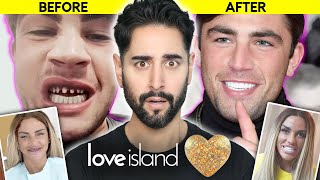 Turkey Teeth: The Beauty Trend That Could Ruin Your Life