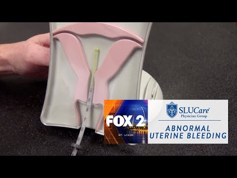 Abnormal Uterine Bleeding - SLUCare Health Watch