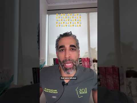 Rib Cartilage for a Nose Job?! #nosejob #rhinoplastybeforeandafter