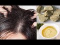 How To Use Multani Mitti To Get Rid Of Dandruff Instantly Multani Mitti Hair Pack For Itchy Scalp