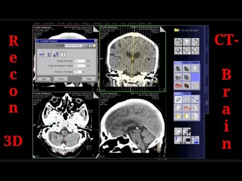 Refurbished 16 Slice CT Scanner