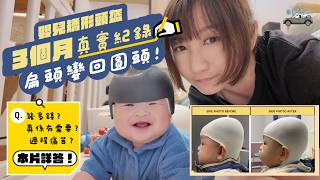 扁頭影響BB發育👶🏻？矯形頭盔3個月真實效果！如何檢查/實際費用/家長必睇指南