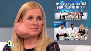 Parotidectomy for Large Facial Tumor Removal, Parotid Gland: The Doctors TV Show